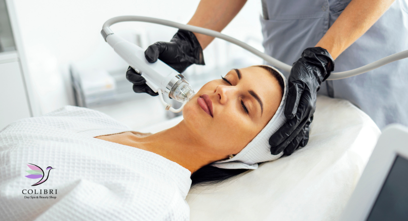 microneedling facial in sarasota